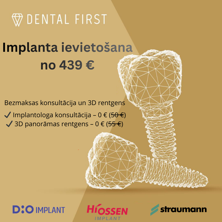 Dental implant offer with free consultation