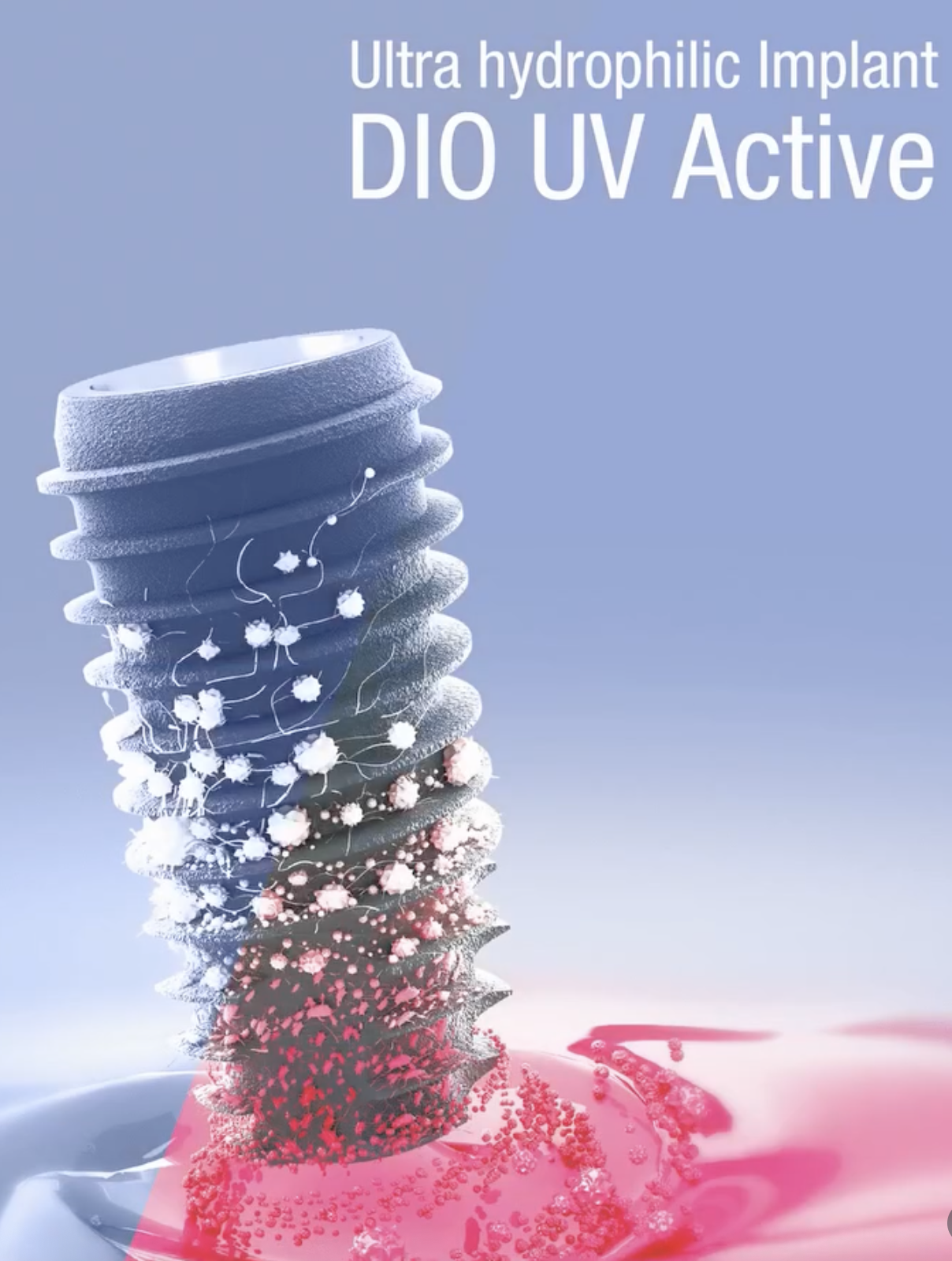 Визуализация зубного импланта