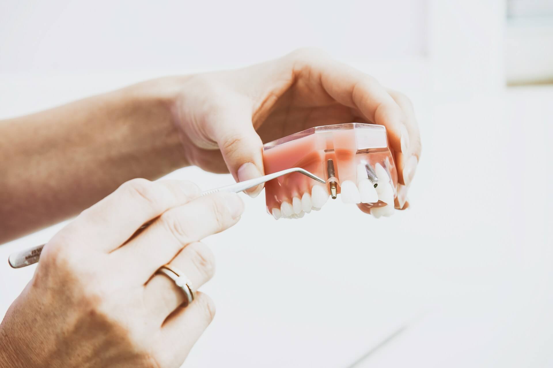 Model of a dental implant and prosthetic tooth